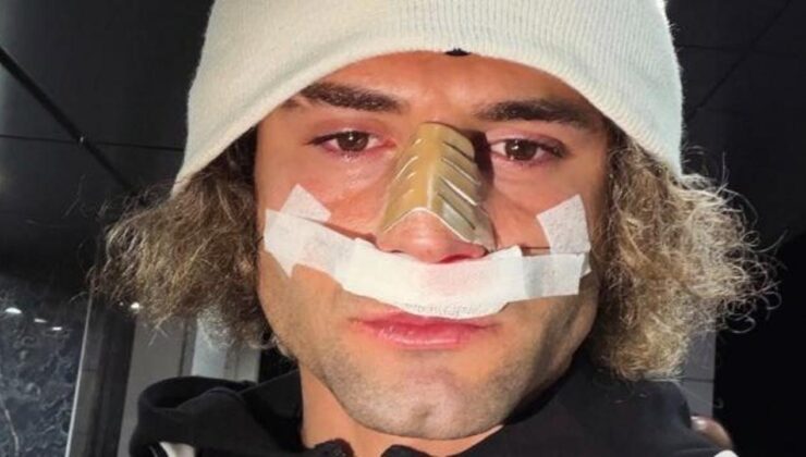 2. Lig’in gol hükümdarının burnu kırıldı! Maçı bu halde tamamladı